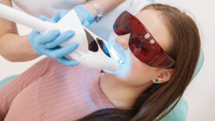 Teeth whitening trends in Marrakech, an overview from Moqadem Dental Clinic