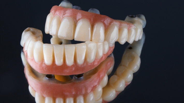 The Impact of Aging on Dental Implants