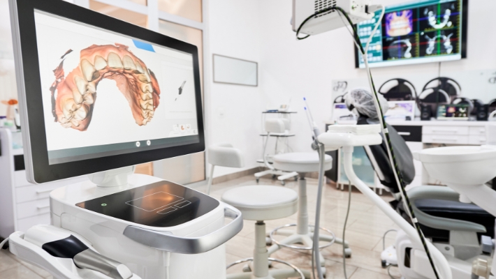 The Role of Digital Scanners in Dental Veneer Design