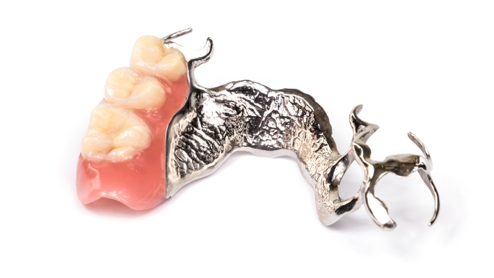 Dental Implants for Patients with Removable Dentures