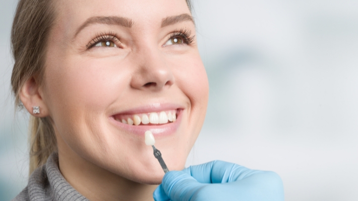 Frequently Asked Questions About Dental Veneers