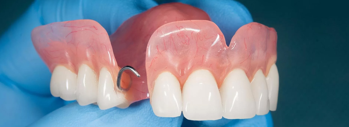 Dental prosthesis